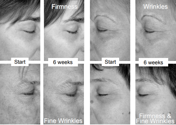 艾詩特蝦青素 艾詩特蝦青素