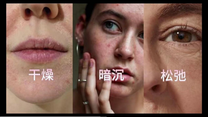 艾詩(shī)特蝦青素 艾詩(shī)特蝦青素