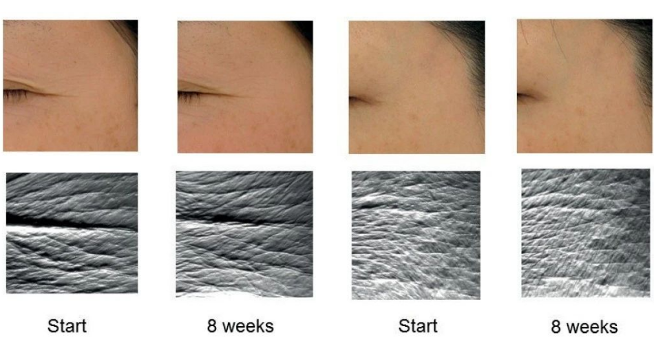 艾詩特蝦青素 艾詩特蝦青素