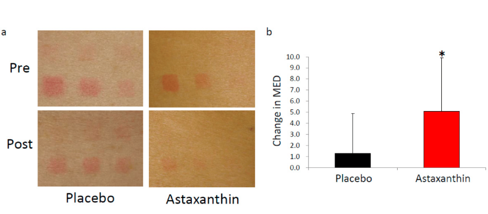 艾詩特蝦青素 艾詩特蝦青素