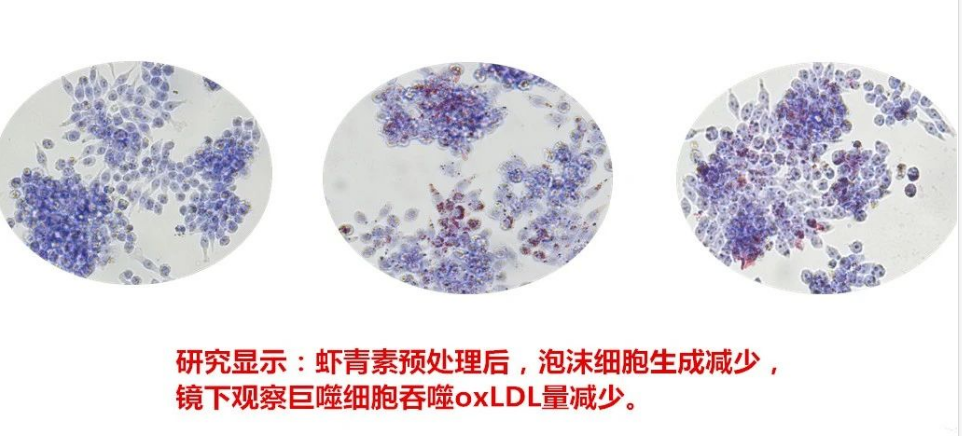 艾詩特蝦青素 艾詩特蝦青素