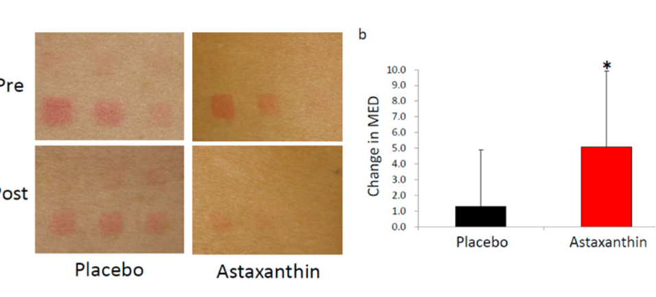 艾詩特蝦青素 艾詩特蝦青素