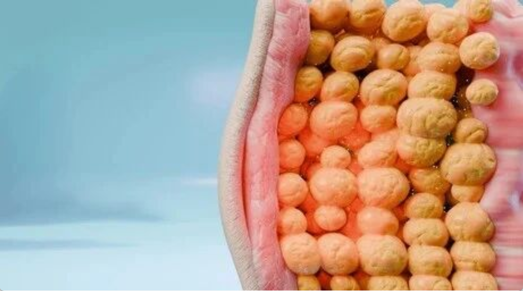 艾詩特蝦青素 艾詩特蝦青素