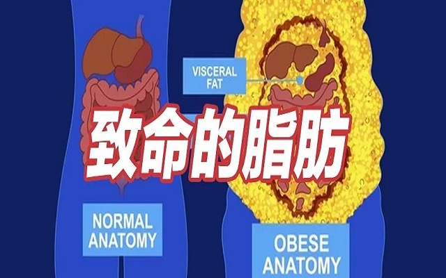 這種致命的脂肪，你可能正在瘋狂囤積！1分鐘自測!